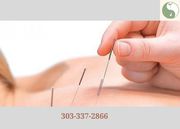 Acupuncture Clinic in Denver