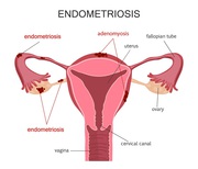 Best Endometriosis Specialist in Abu Dhabi