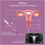 IVF and Genetic Testing in Abu Dhabi